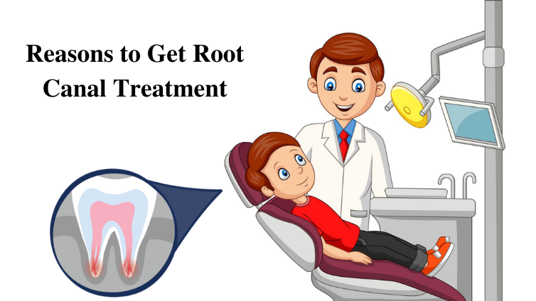 Reasons to Get Root Canal Treatment